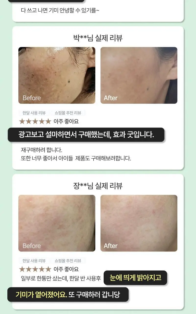 [기미개선] 대웅제약 이지듀 기미잡티앰플 12ml+1ml 기획 상세페이지 6
